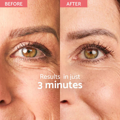 Instant Wrinkle Corrector - Διορθωτής ρυτίδων με άμεση επίδραση (180 εφαρμογές)